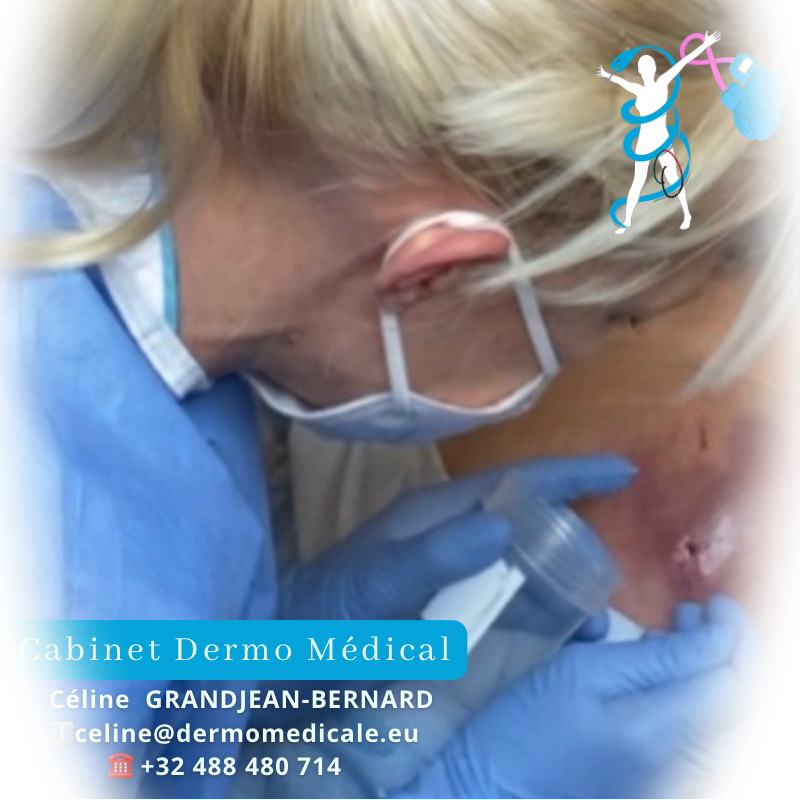 alt="Céline Bernard, soins infirmiers – prise en charge des plaies | Cabinet Dermo Médical, Maisières (Mons)"